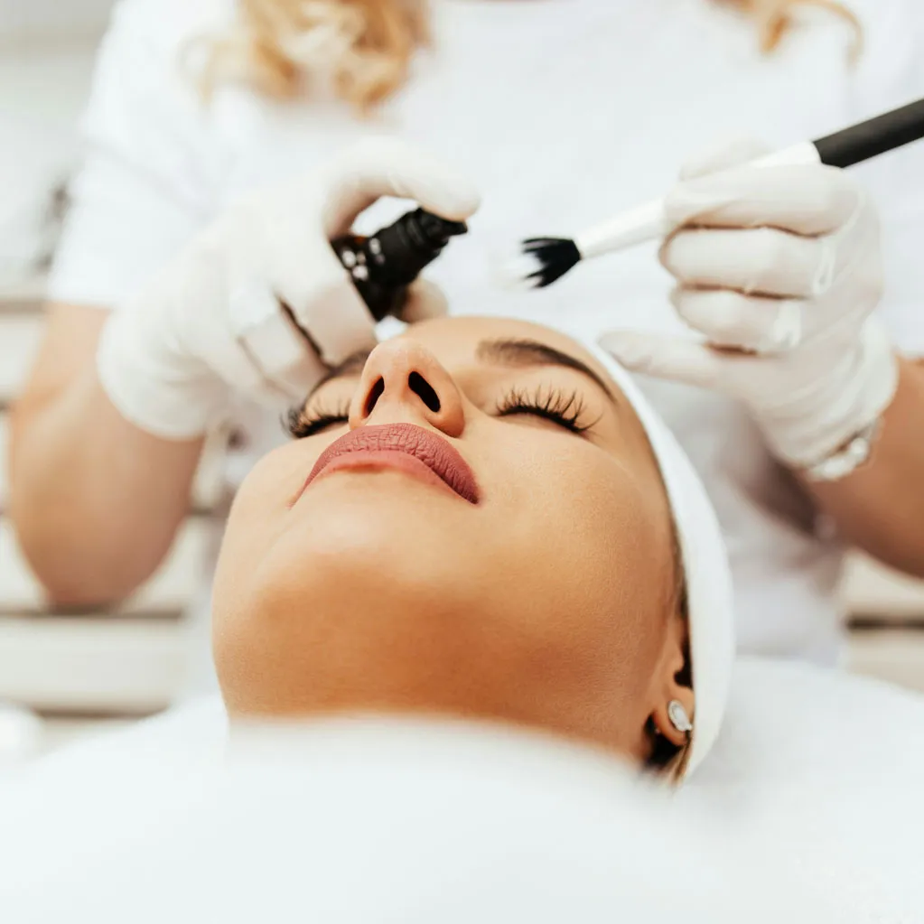 Chemical Peels