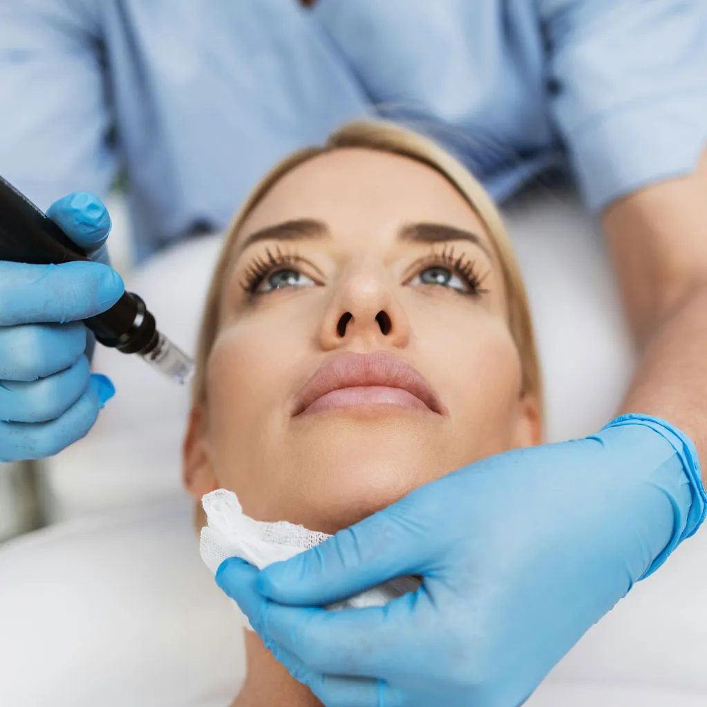 Microneedling